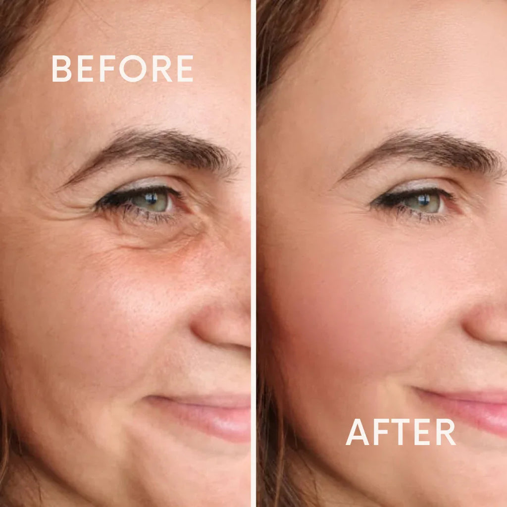 Before and after skincare results showing smoother, younger-looking skin around eyes