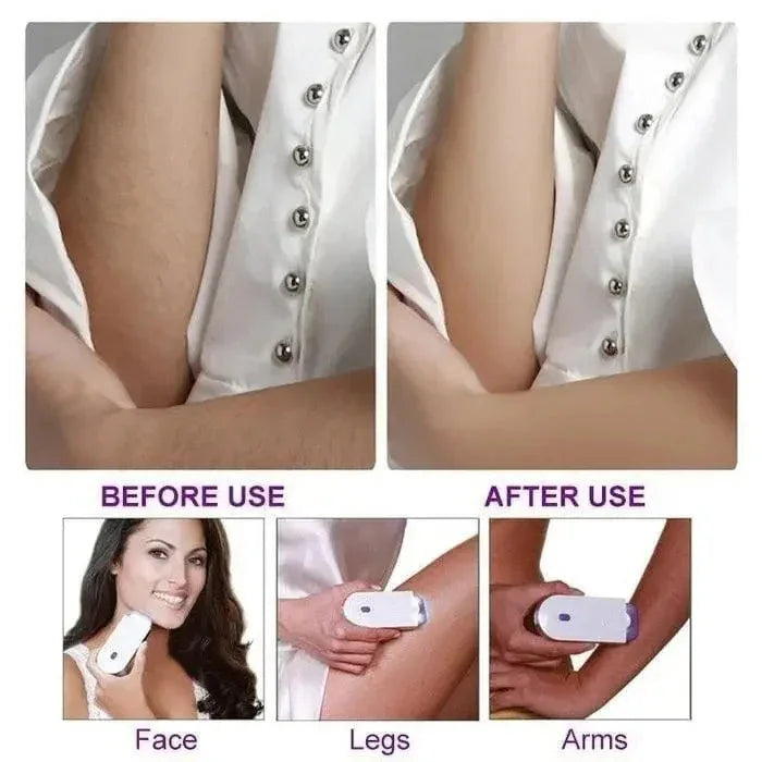 Before and after hair removal results on face, legs, and arms using a handheld beauty tool